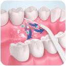 Oral Clean - Irrigador Oral Contra Cáries e Tártaro