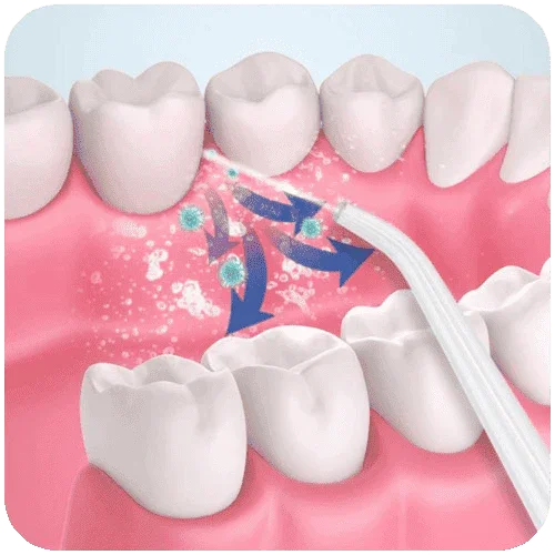 Oral Clean - Irrigador Oral Contra Cáries e Tártaro